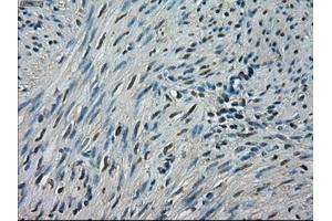 Immunohistochemical staining of paraffin-embedded endometrium tissue using anti-CRYABmouse monoclonal antibody. (CRYAB Antikörper)