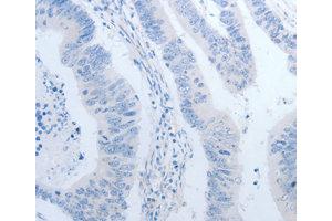 Immunohistochemistry (IHC) image for anti-Neurogenin 1 (NEUROG1) antibody (ABIN1873884) (Neurogenin 1 Antikörper)