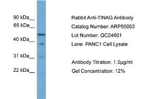 WB Suggested Anti-TINAG  Antibody Titration: 0. (TINAG Antikörper  (Middle Region))