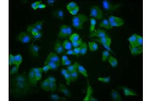 Immunofluorescence staining of MCF-7 cells with ABIN7171412 at 1:266, counter-stained with DAPI.