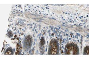 ABIN6274510 at 1/100 staining Mouse intestine tissue by IHC-P. (Sema4a Antikörper  (Internal Region))