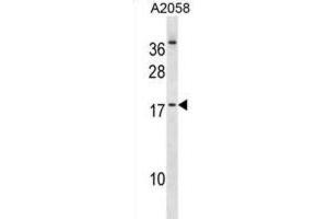 Western Blotting (WB) image for anti-Nescient Helix Loop Helix 2 (NHLH2) antibody (ABIN2998885)