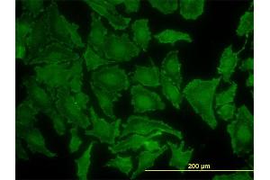 Immunofluorescence (IF) image for anti-GTPase Kras (KRAS) (AA 1-188) antibody (ABIN561621)