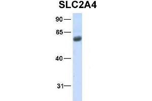 Western Blotting (WB) image for anti-Solute Carrier Family 2 (Facilitated Glucose Transporter), Member 4 (SLC2A4) (N-Term) antibody (ABIN2781558)