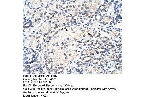Rabbit Anti-MRM1 Antibody  Paraffin Embedded Tissue: Human Kidney Cellular Data: Epithelial cells of renal tubule Antibody Concentration: 4. (MRM1 Antikörper  (C-Term))