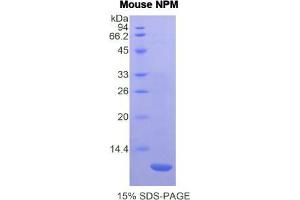 SDS-PAGE analysis of Mouse Nucleophosmin Protein.
