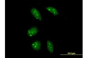 Immunofluorescence of purified MaxPab antibody to GLTSCR2 on HeLa cell. (GLTSCR2 Antikörper  (AA 1-478))