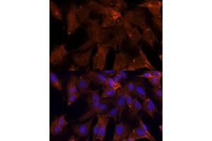 Immunofluorescence analysis of C6 cells using PGK2 Polyclonal Antibody (ABIN6128431, ABIN6145506, ABIN6145507 and ABIN6216775) at dilution of 1:100 (40x lens).