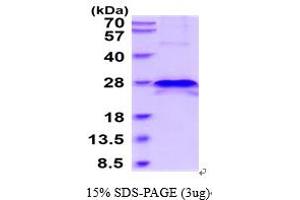 SDS-PAGE (SDS) image for TIMP Metallopeptidase Inhibitor 4 (TIMP4) (AA 30-224) protein (His tag) (ABIN6387857)