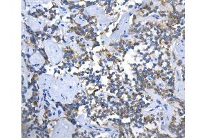 IHC analysis of ASS1 using anti-ASS1 antibody (ABIN7601190). (ASS1 Antikörper  (AA 3-365))