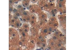 IHC-P analysis of Kidney tissue, with DAB staining. (PSMD6 Antikörper  (AA 1-389))