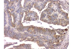 IHC analysis of Cystatin C/CST3 using anti-Cystatin C/CST3 antibody (ABIN6719299). (CST3 Antikörper  (AA 31-146))
