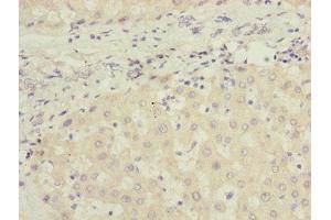 Immunohistochemistry of paraffin-embedded human liver tissue using ABIN7165663 at dilution of 1:100 (PHF17 Antikörper  (AA 543-842))