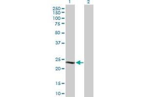Western Blot analysis of CSN1S1 expression in transfected 293T cell line by CSN1S1 MaxPab polyclonal antibody. (Casein alpha S1 Antikörper  (AA 1-185))