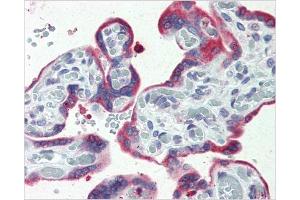 Immunohistochemical staining of Placenta using AP31137PU-N ERP44 antibody (ERP44 Antikörper  (C-Term))