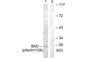 Western blot analysis of extracts from COS7 cells, treated with TNF-a (20ng/ml, 30mins), using BAD (Phospho-Ser91/128) antibody.