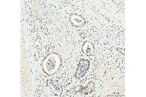 IHC analysis of DDX1 using anti-DDX1 antibody (ABIN7602050).