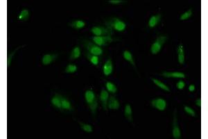 Immunofluorescence staining of Hela cells with nforHU at 1:12. (HIST1H1C Antikörper)