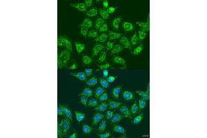Immunofluorescence analysis of U2OS cells using UBE2A antibody (ABIN6132759, ABIN6149781, ABIN6149783 and ABIN6216187) at dilution of 1:100. (UBE2A Antikörper  (AA 1-152))