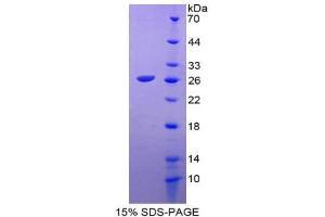 SDS-PAGE (SDS) image for Prekallikrein (PK) (AA 156-364) protein (His tag) (ABIN2126399) (Prekallikrein Protein (PK) (AA 156-364) (His tag))