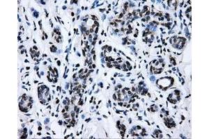 Immunohistochemical staining of paraffin-embedded breast tissue using anti-RALBP1 mouse monoclonal antibody. (RALBP1 Antikörper)