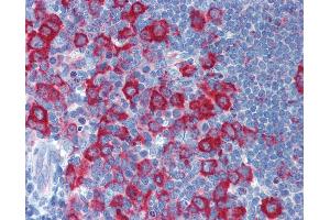 Immunohistochemistry (IHC) image for anti-Protein Kinase, Interferon-Inducible Double Stranded RNA Dependent Activator (PRKRA) (N-Term) antibody (ABIN6747048)