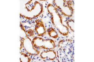 Immunohistochemistry (Paraffin-embedded Sections) (IHC (p)) image for anti-Ribosomal Protein S6 (RPS6) antibody (ABIN6242615)
