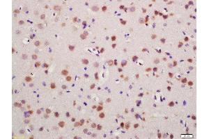Formalin-fixed and paraffin embedded mouse brain labeled with Rabbit Anti-Glutamine synthetase Polyclonal Antibody, Unconjugated (ABIN754468) at 1:200 followed by conjugation to the secondary antibody and DAB staining (GLN1 Antikörper  (AA 285-373))