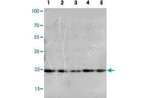 Western blot analysis of whole cell extracts with FGF10 polyclonal antibody . (FGF10 Antikörper  (N-Term))