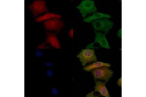 ABIN6266361 and ABIN6277098 staining Hela cells by IF/ICC.