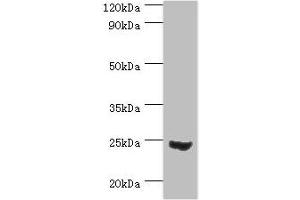 Western blot All lanes: Mitotic spindle assembly checkpoint protein MAD2A antibody at 3 μg/mL + 293T whole cell lysate Secondary Goat polyclonal to rabbit IgG at 1/10000 dilution Predicted band size: 24, 11 kDa Observed band size: 24 kDa