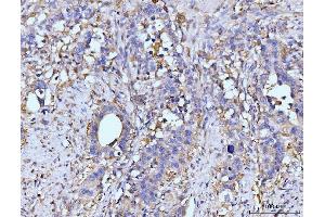 IHC analysis of GLUL using anti-GLUL antibody (ABIN7602403). (GLUL Antikörper  (AA 74-373))