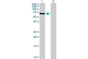 Western Blot analysis of MUTYH expression in transfected 293T cell line by MUTYH MaxPab polyclonal antibody. (MUTYH Antikörper  (AA 1-535))