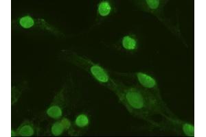 Anti-MAPK6 mouse monoclonal antibody (ABIN2452376) immunofluorescent staining of HeLa cells transiently transfected by pCMV6-ENTRY MAPK6 (RC201597) (MAPK6 Antikörper  (AA 345-721))
