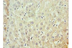 Immunohistochemistry of paraffin-embedded human liver tissue using ABIN7159091 at dilution of 1:100 (MKS1 Antikörper  (AA 150-300))