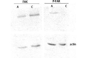 Western Blot (WB) analysis of lysis using FAK antibody. (FAK Antikörper  (Thr402, Thr421, Thr423))