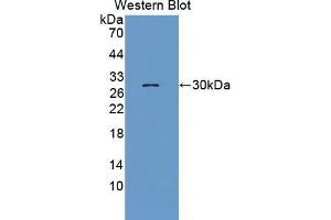 Western blot analysis of the recombinant protein. (NUP62 Antikörper  (AA 186-432))