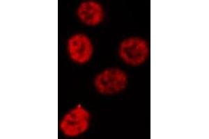 Immunofluorescence (fixed cells) (IF/ICC) image for anti-Nuclear Factor of kappa Light Polypeptide Gene Enhancer in B-Cells 1 (NFKB1) (C-Term) antibody (ABIN6263615)