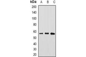 Western blot analysis of GFRA1 expression in MCF7 (A), A549 (B), SW480 (C) whole cell lysates.