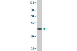 Western Blot detection against Immunogen (36. (GIMAP4 Antikörper  (AA 125-224))