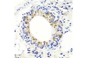 Immunohistochemistry of paraffin-embedded mouse lung using ENDOG antibody at dilution of 1:100 (x40 lens). (Endonuclease G Antikörper)