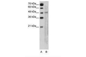 Image no. 1 for anti-Solute Carrier Family 25, Member 46 (SLC25A46) (AA 31-80) antibody (ABIN205025)