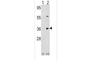 Western blot analysis of THPO (arrow) using rabbit polyclonal THPO Antibody (Center) (ABIN391803 and ABIN2841657). (Thrombopoietin Antikörper  (AA 243-273))