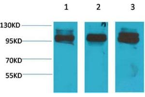 Western Blot (WB) analysis of 1) K562, 2)Mouse Heart Tissue, 3) Rat Heart Tissue with STAT2 Rabbit Polyclonal Antibody diluted at 1:2000. (STAT2 Antikörper)