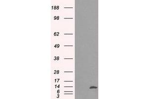 Image no. 4 for anti-Inhibitor of DNA Binding 3, Dominant Negative Helix-Loop-Helix Protein (ID3) antibody (ABIN1498780)
