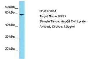 Image no. 1 for anti-Peptidylprolyl Isomerase (Cyclophilin)-Like 4 (PPIL4) (C-Term) antibody (ABIN6750716) (PPIL4 Antikörper  (C-Term))