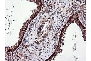 Image no. 1 for anti-Tumor Protein P73 (TP73) (AA 167-409) antibody (ABIN1491006) (Tumor Protein p73 Antikörper  (AA 167-409))