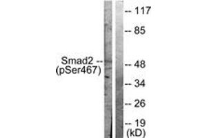 Western blot analysis of extracts from HepG2 cells treated with PMA 125ng/ml 15', using Smad2 (Phospho-Ser467) Antibody. (SMAD2 Antikörper  (pSer467))
