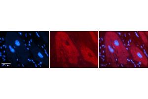 Rabbit Anti-DHX30 Antibody    Formalin Fixed Paraffin Embedded Tissue: Human Adult heart  Observed Staining: Cytoplasmic Primary Antibody Concentration: 1:100 Secondary Antibody: Donkey anti-Rabbit-Cy2/3 Secondary Antibody Concentration: 1:200 Magnification: 20X Exposure Time: 0.