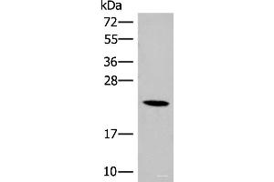 Western blot analysis of 293T cell lysate using DHFR Polyclonal Antibody at dilution of 1:400 (Dihydrofolate Reductase Antikörper)